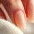 Pofalowane paznokcie: Przyczyny, objawy i skuteczne leczenie